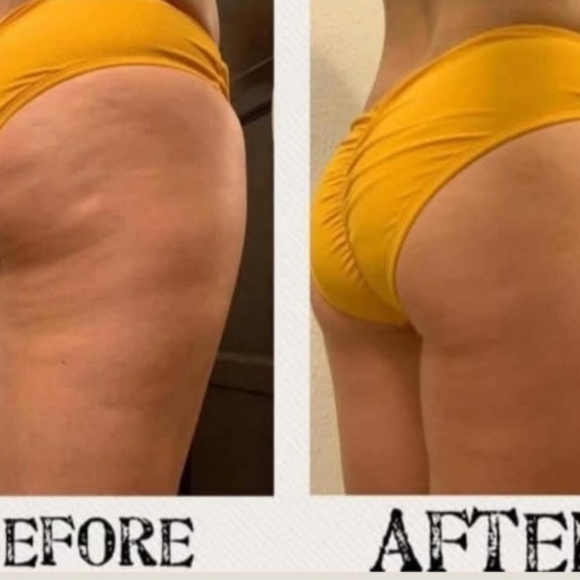 Smooth The Cellulite - Picture 4 of 7